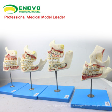 DENTAL22 (12604) Huamn modelo de desenvolvimento de dentes de feto infantil com 4 peças de modelos dentais